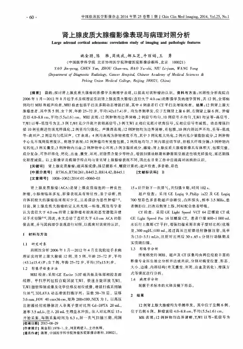 肾上腺皮质大腺瘤影像表现与病理对照分析