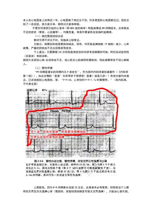 心电图基本讲解