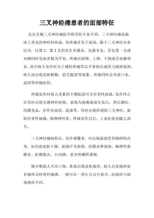 三叉神经痛患者的面部特征