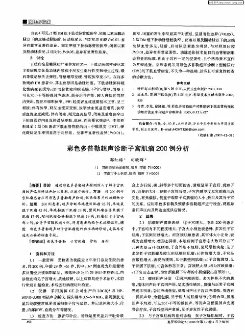 彩色多普勒超声诊断子宫肌瘤200例分析