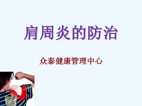 肩周炎的防治