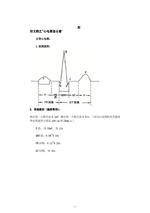 实用文档之心电图怎么看