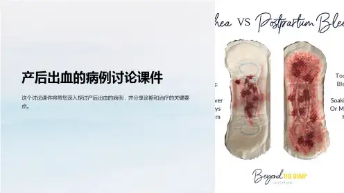 产后出血的病例讨论课件