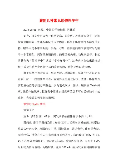 鉴别几种常见的假性卒中