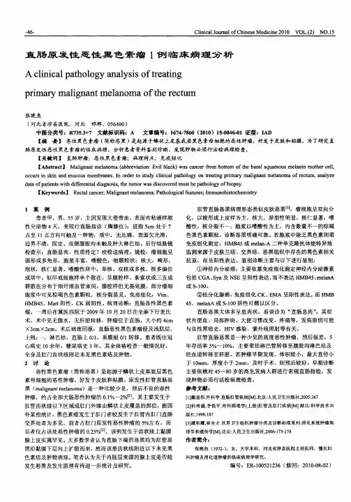 直肠原发性恶性黑色素瘤1例临床病理分析