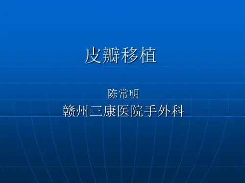 皮瓣移植术