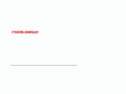 ST段抬高心肌梗死治疗