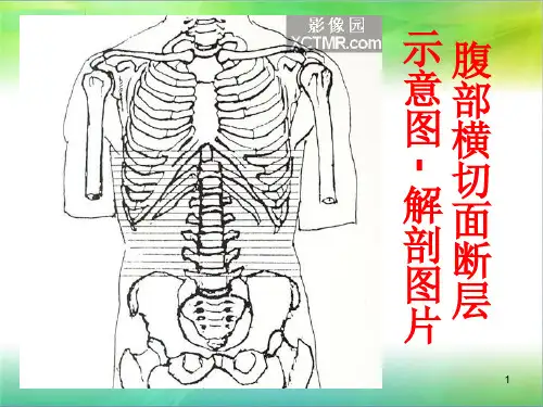 腹部断层解剖和断层CTppt课件