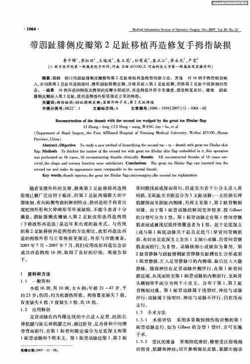 带拇趾腓侧皮瓣第2足趾移植再造修复手拇指缺损