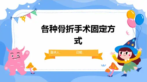 各种骨折手术固定方式