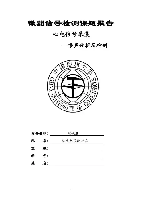 心电信号采集及系统设计