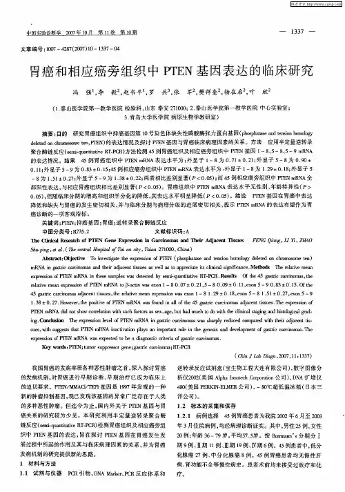胃癌和相应癌旁组织中PTEN基因表达的临床研究