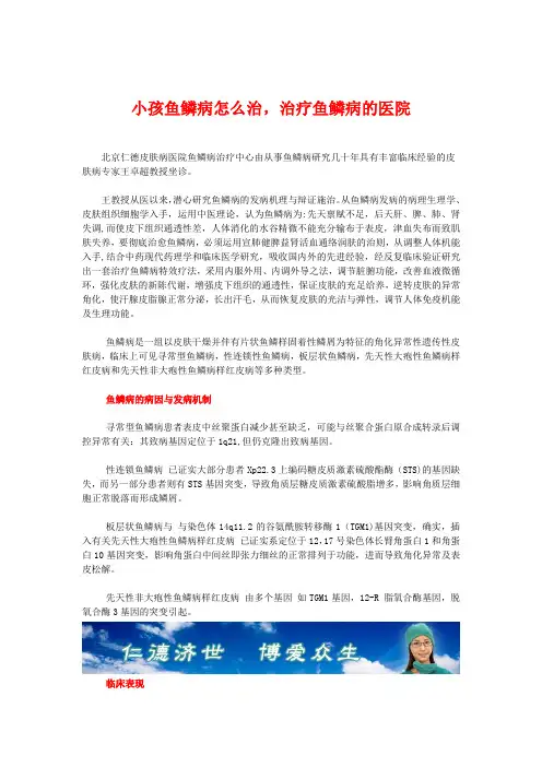 小孩鱼鳞病怎么治,治疗鱼鳞病的医院
