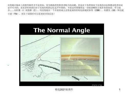 房角镜检查