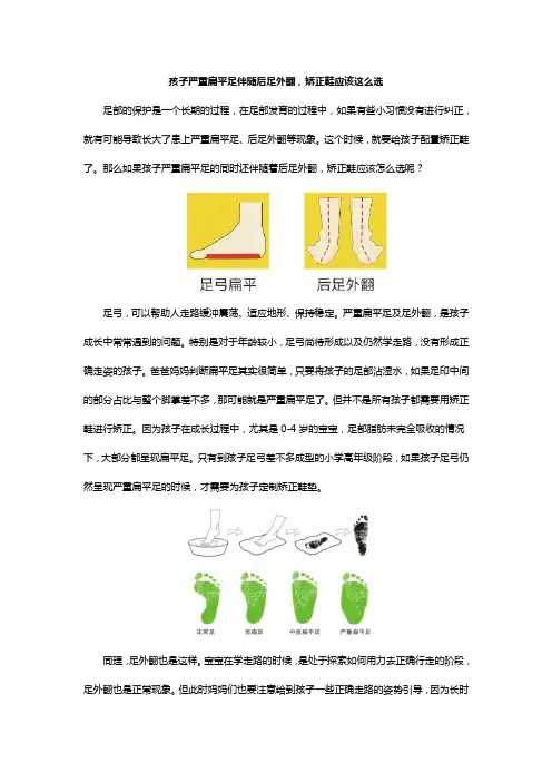 孩子严重扁平足伴随后足外翻,矫正鞋应该这么选