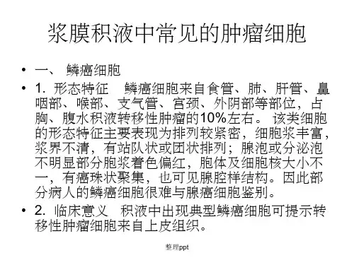 常见肿瘤细胞