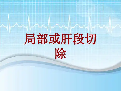 外科手术教学资料:局部或肝段切除讲解模板