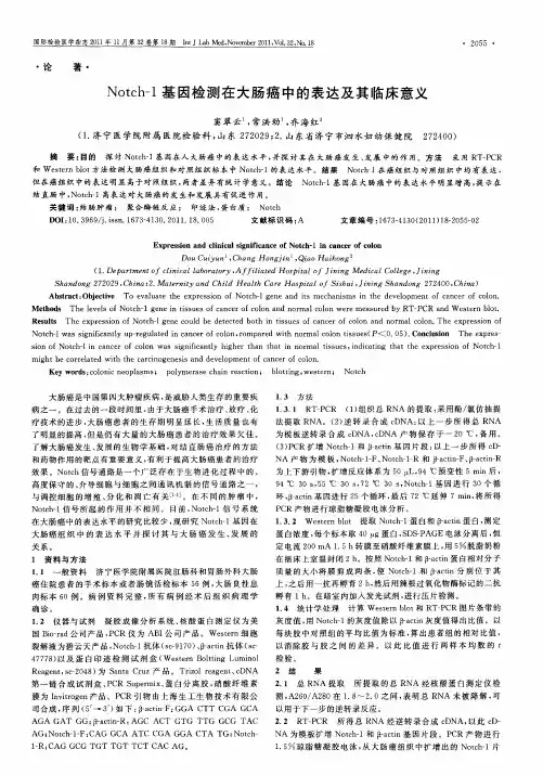 Notch-1基因检测在大肠癌中的表达及其临床意义