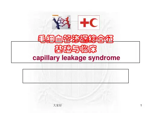 毛细血管渗漏 PPT