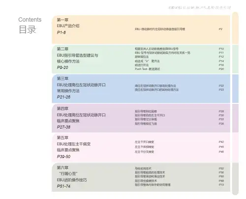 EBU指引导管选型建议与核心操作方法