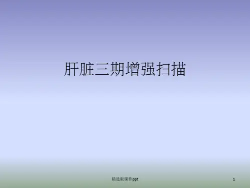 肝脏三期增强扫描