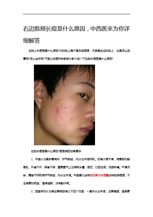 右边脸颊长痘是什么原因,中西医来为你详细解答