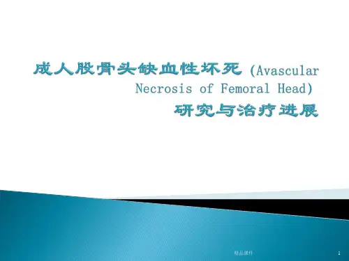 成人股骨头缺血性坏死医学PPT