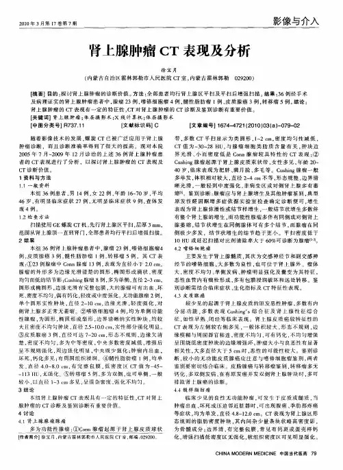 肾上腺肿瘤CT表现及分析