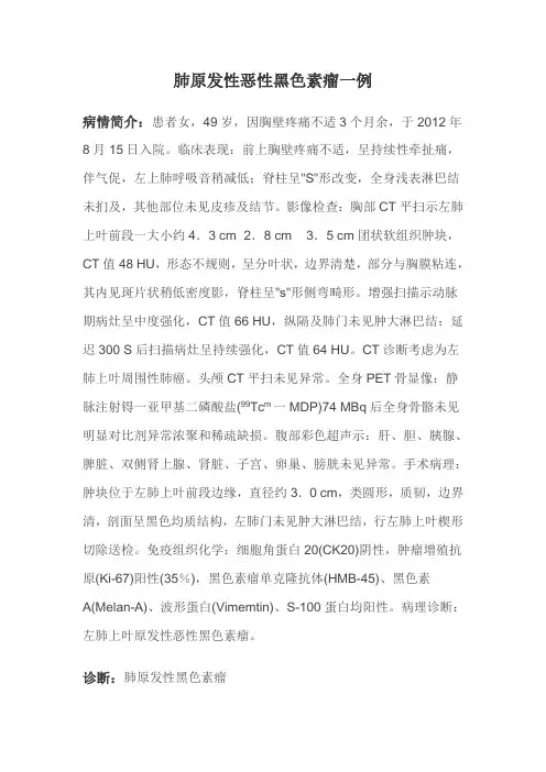 肺原发性黑色素瘤