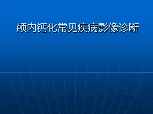 颅内钙化常见疾病影像诊断PPT课件