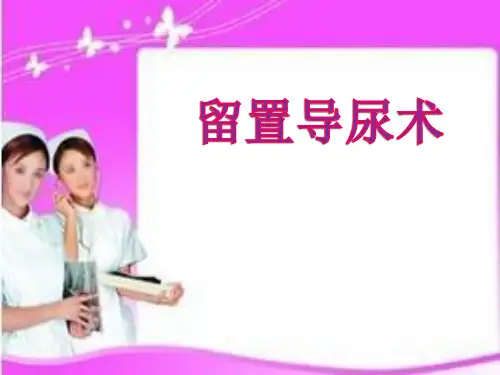 导尿Microsoft Office PowerPoint 演示文稿