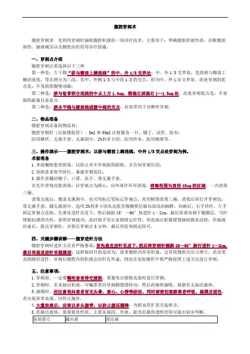 腹腔穿刺术