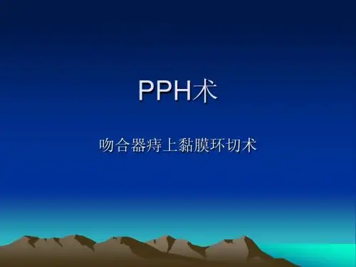 PPH术