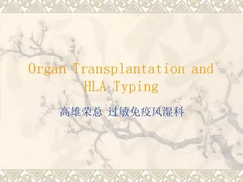器官移植