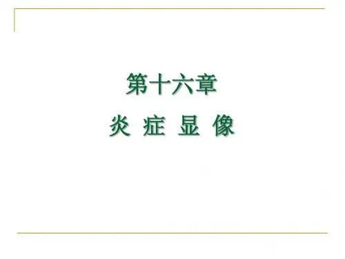 第十六章炎症显像