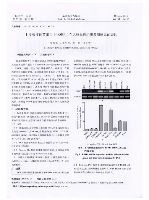 上皮剪接调节蛋白1(ESRP1)在人卵巢癌组织及细胞系的表达