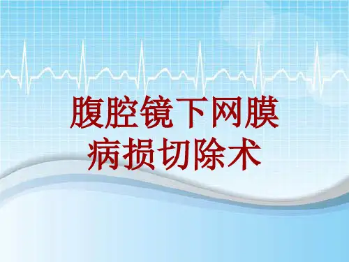 手术讲解模板:腹腔镜下网膜病损切除术