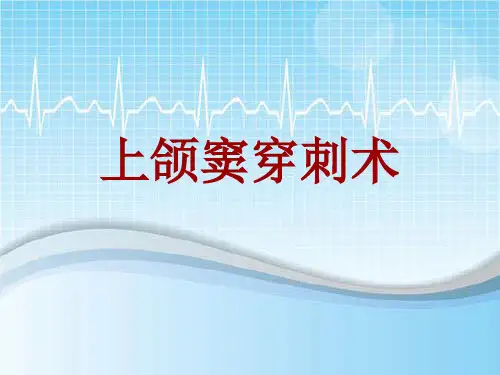 手术讲解模板：上颌窦穿刺术