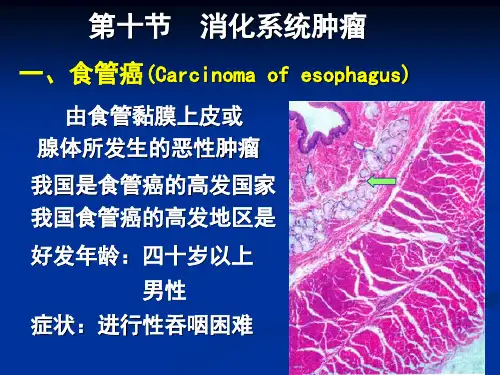 消化管癌的病理表现