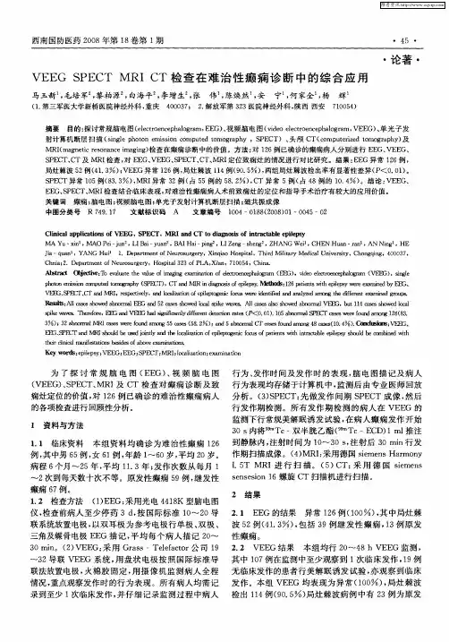 VEEG SPECT MRI CT检查在难治性癫痫诊断中的综合应用