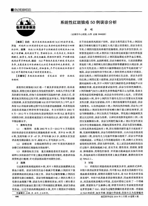 系统性红斑狼疮50例误诊分析