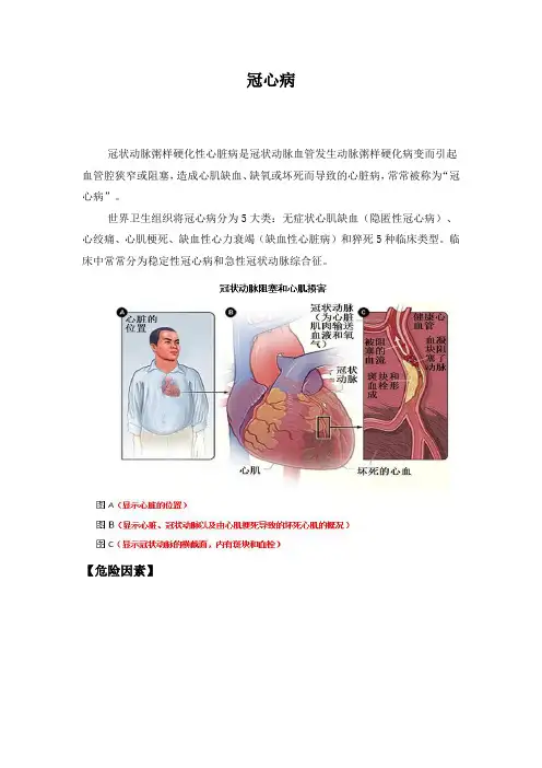 冠心病的健康教育 4