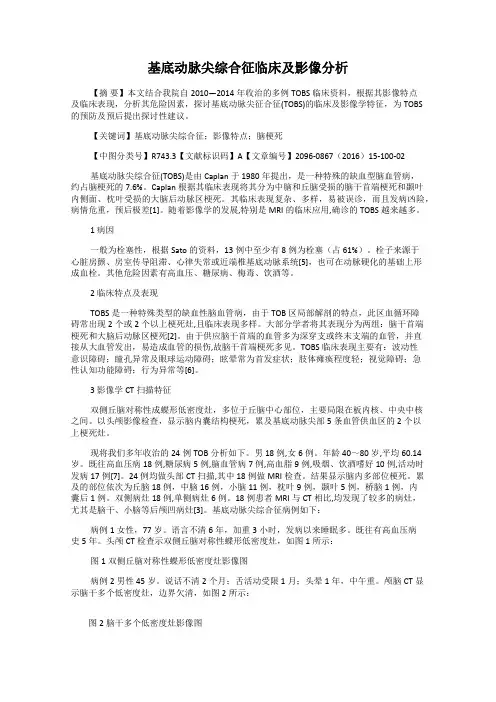基底动脉尖综合征临床及影像分析
