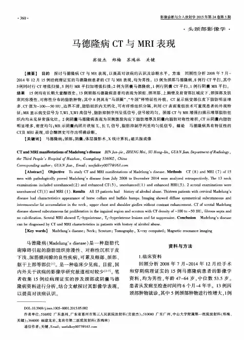 马德隆病CT与MRI表现