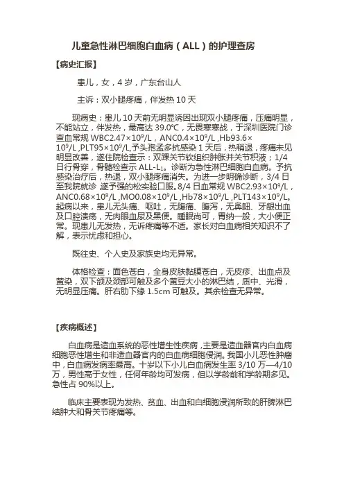 急性淋巴细胞白血病 2
