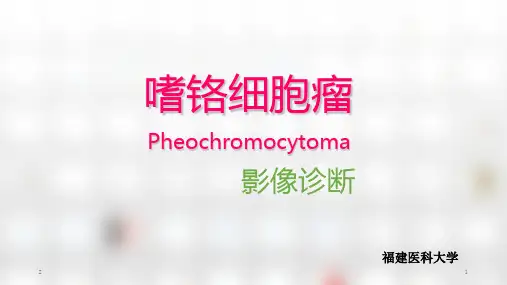 嗜铬细胞瘤影像诊断最新版本参考课件