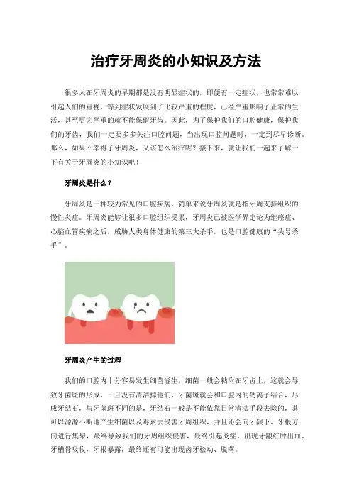 治疗牙周炎的小知识及方法
