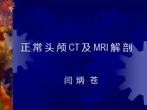 正 常 头 颅 CT 及 MRI 解 剖