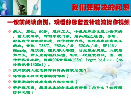 静脉留置针输液法