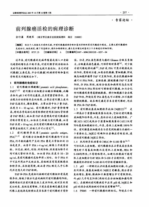 前列腺癌活检的病理诊断
